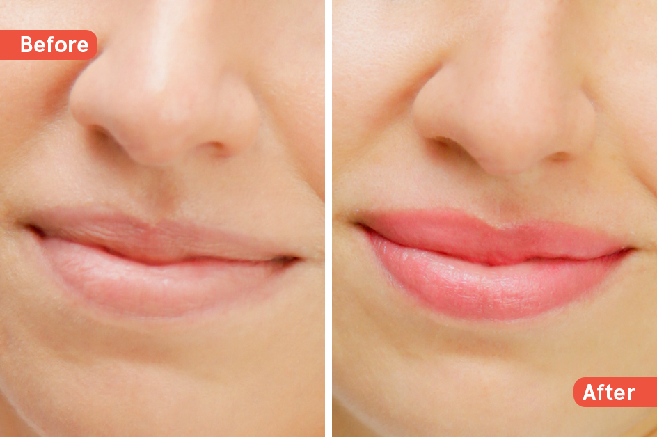 antes y después de la micropigmentación en los labios