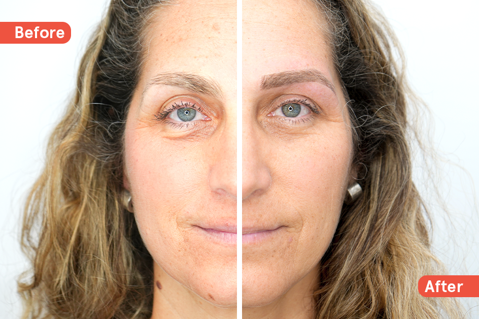 Antes y después de la micropigmentación de cejas