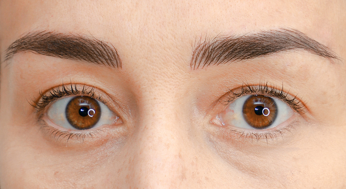 Fases del microblading